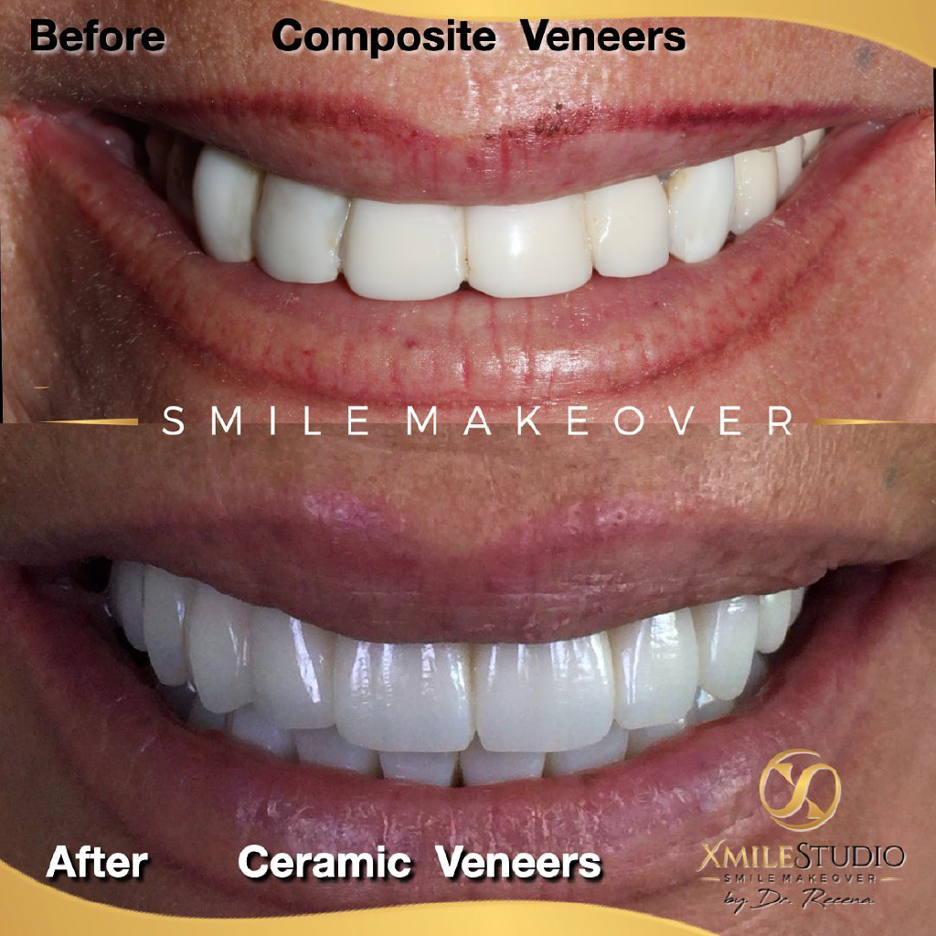 Soluciones personalizadas para cuidar de tu sonrisa y mejorar tu salud bucal