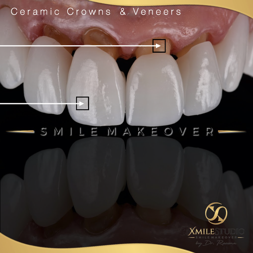 Sonrisa6 Xmile Studio